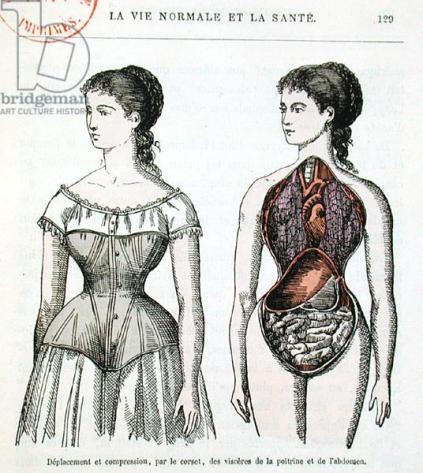 The Harmful Effects of the Corset, illustration from 'La Vie Normale et la Sante' by Dr Jules Rengade (b.1841) c.1880 (colour litho)